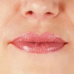 101037-thumbnail-400×400